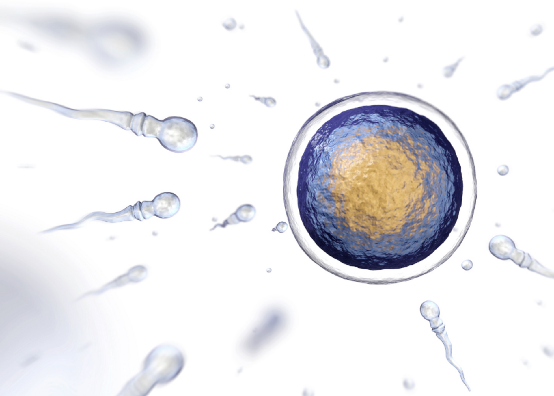 ICSI (Intracytoplasmic Sperm Injection)