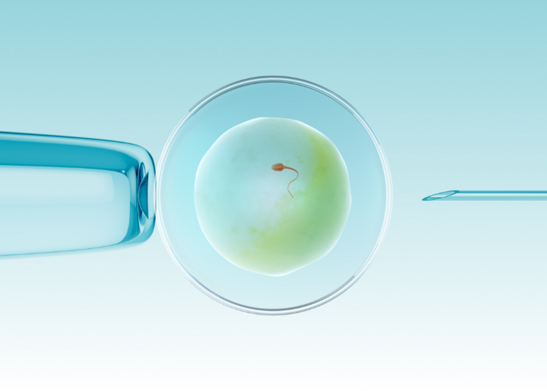 IVF (In Vitro Fertilization)