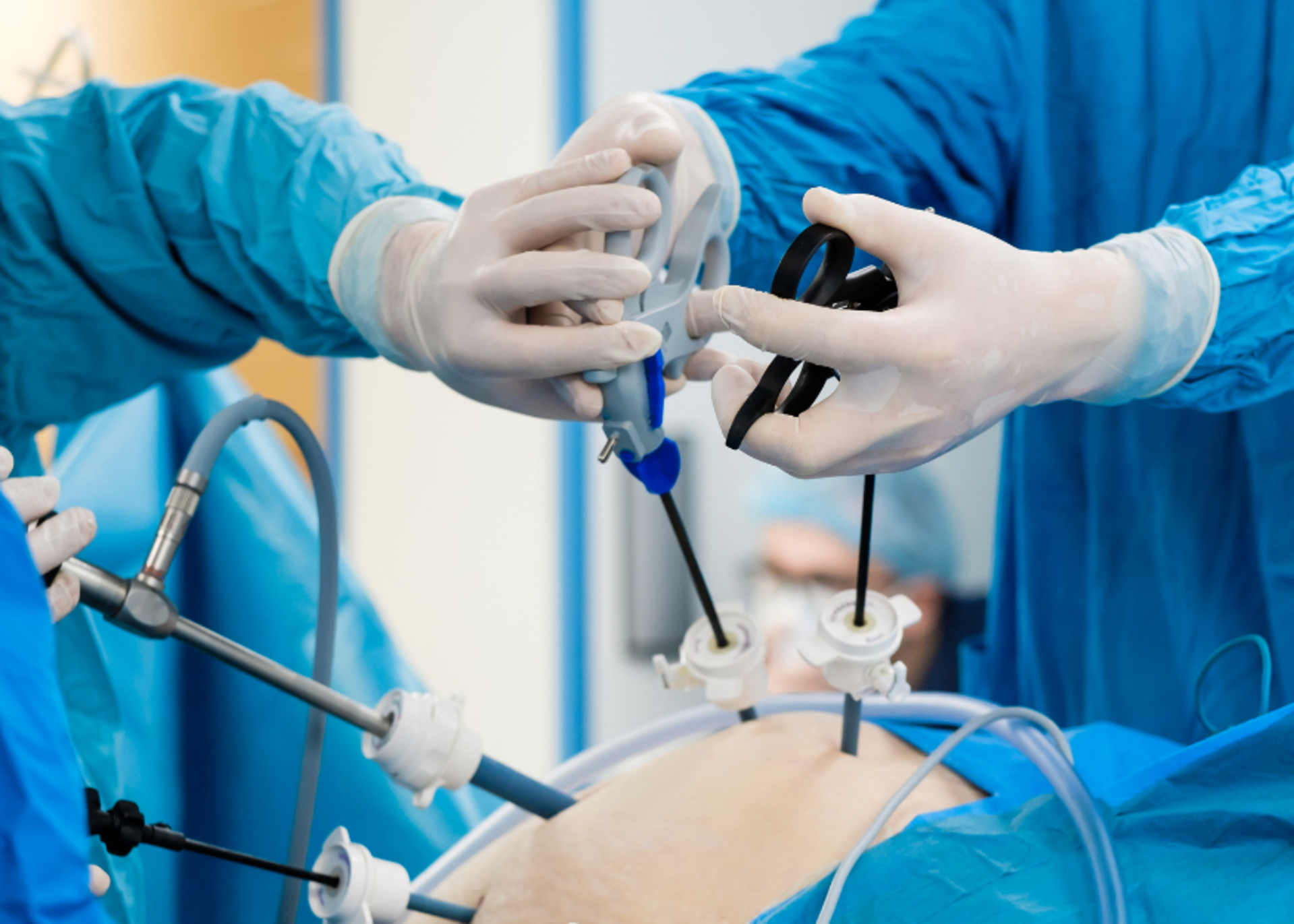 Hysterectomy (Laparoscopic &amp; Open)