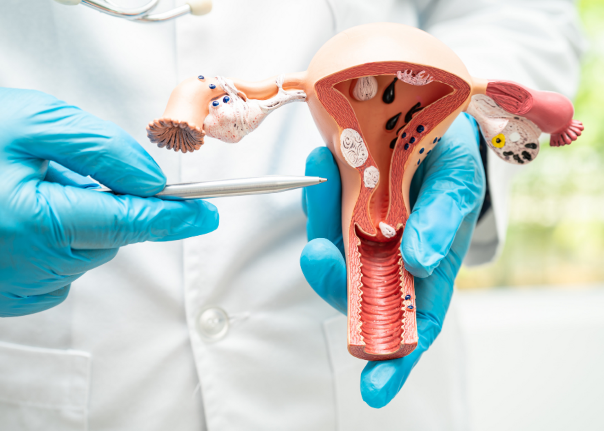 Cervical Cancer Screening &amp; HPV Vaccination