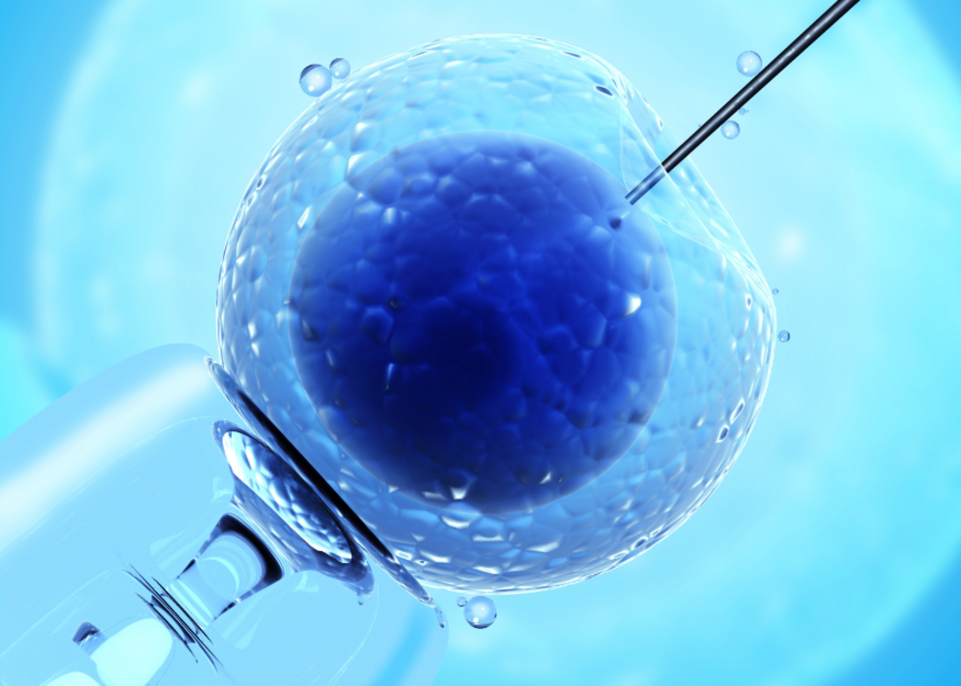 IUI (Intrauterine Insemination)